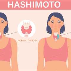 Hashimoto